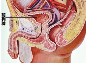 慢性前列腺炎的癥狀及其影響，慢性前列腺炎的癥狀及影響概述